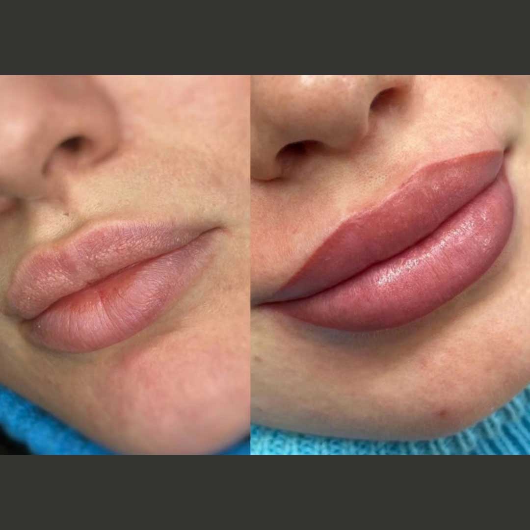 permanent-great-Lippenbehandlung