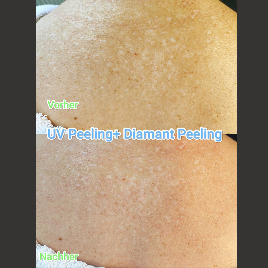 permanent-great-uv-diamant-peeling